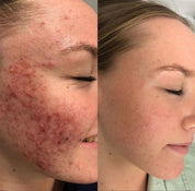 Hyaluronic Hydrating Serum
