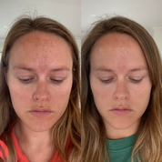 Encapsulated Retinol 0.25% Level 1