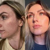 Ageless Hyaluronic Serum